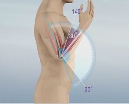 Elbow Contracture